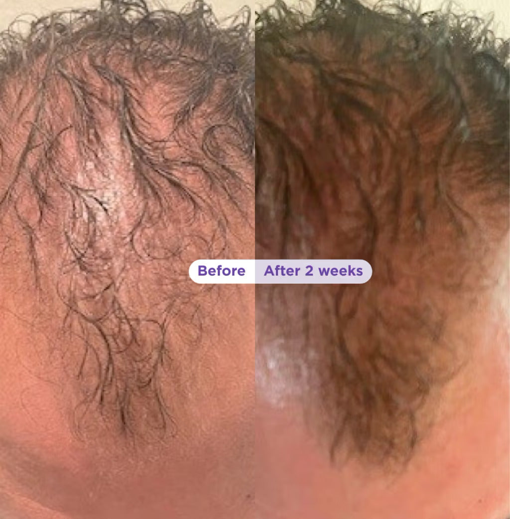 Biotin & Rosemary Thickening Shampoo & Conditioner Set