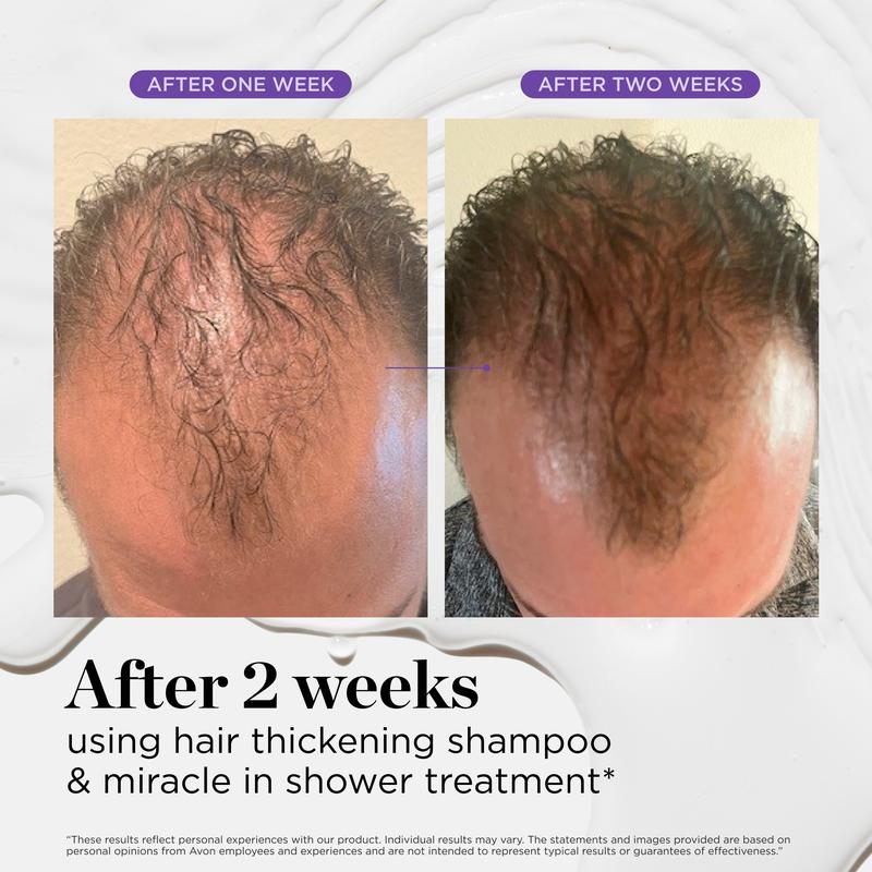 Hair & Scalp Dynamic Duo Set